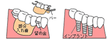 CvgƓꎕ